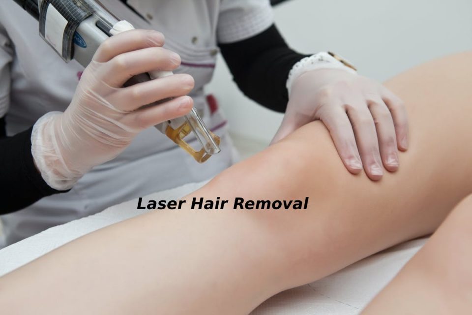 Laser Hair Removal