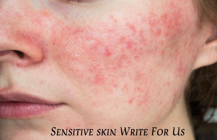 Sensitive skin Write For Us