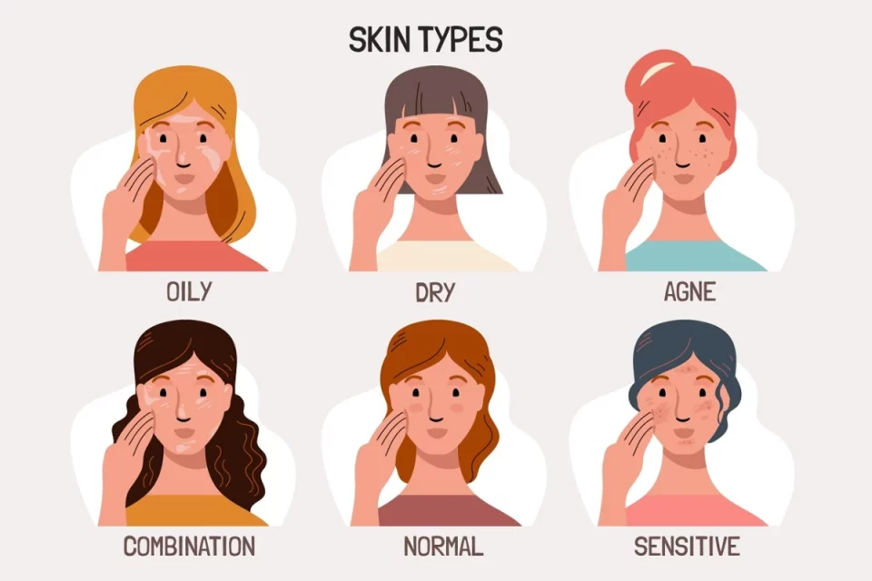 Skin Type